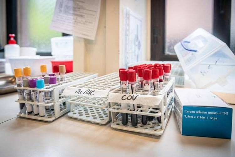 Medicina di laboratorio: un esame semplice per la diagnosi precoce delle malattie